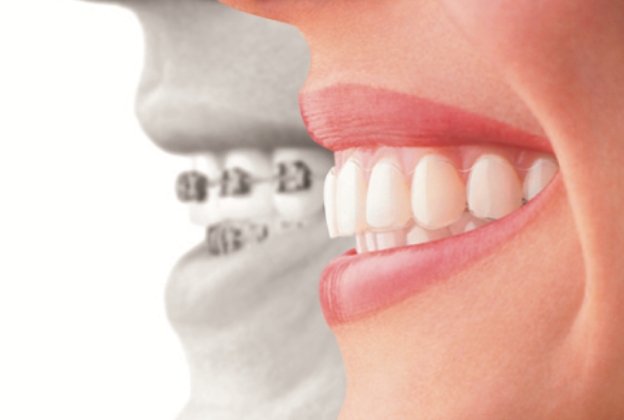 歯列矯正の料金を知りたい方