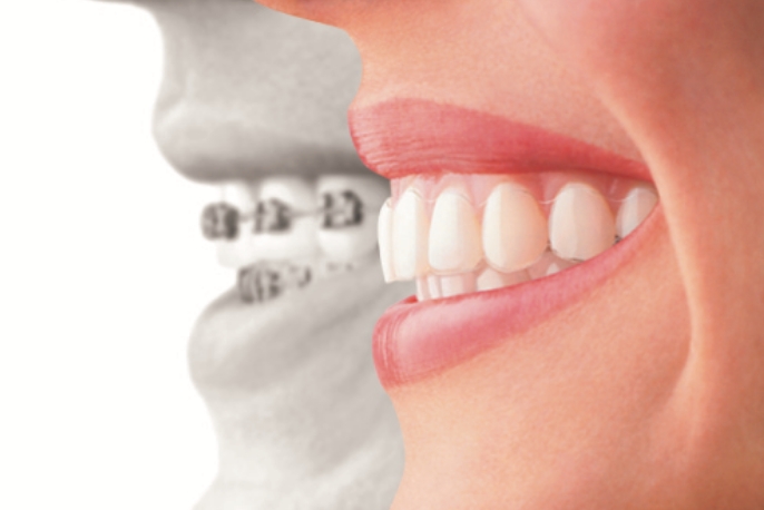 歯列矯正の料金を知りたい方