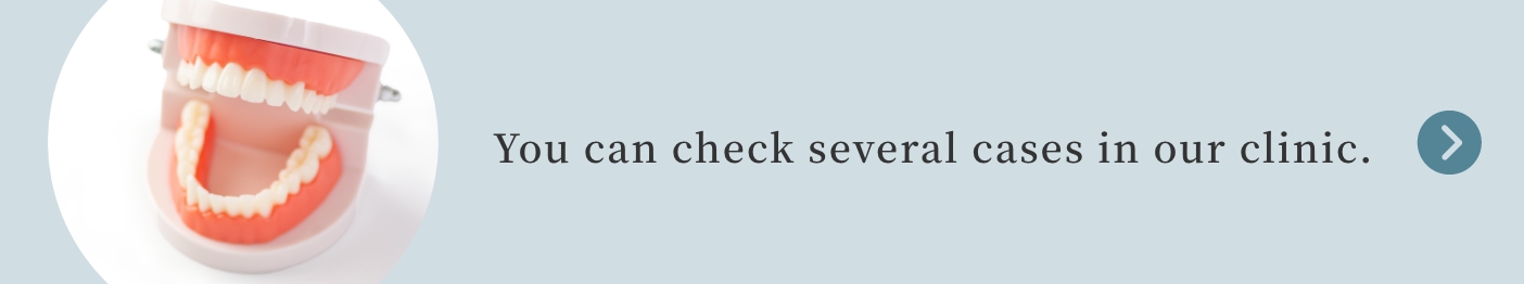 You can check several cases in our clinic.