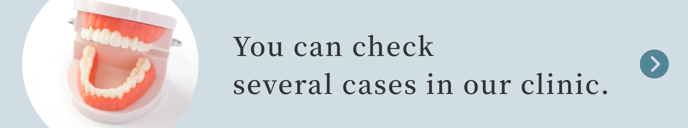 You can check several cases in our clinic.