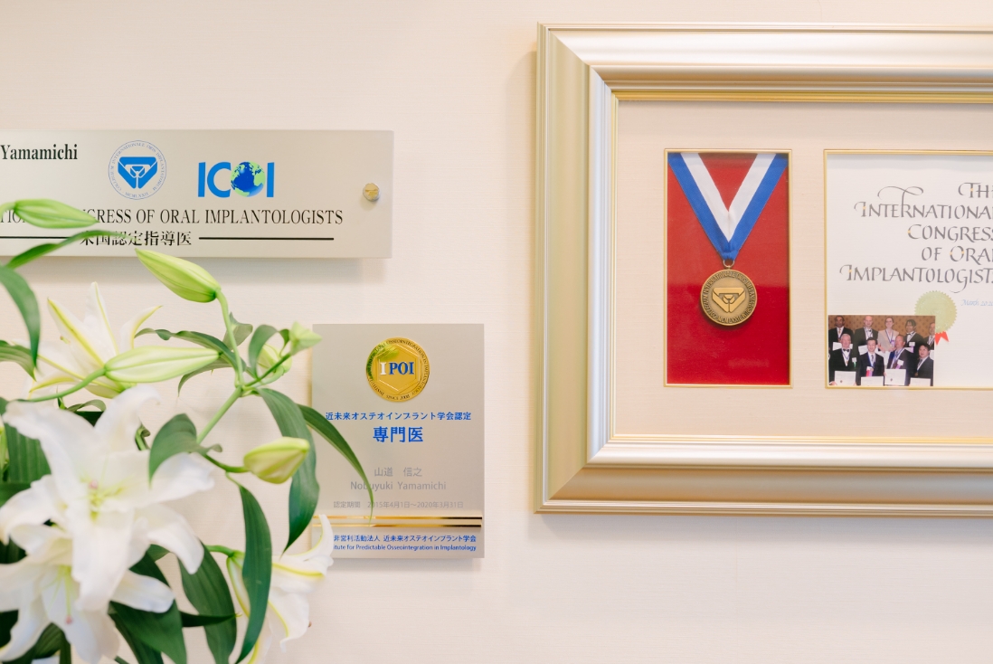 インプラントの認定資格について