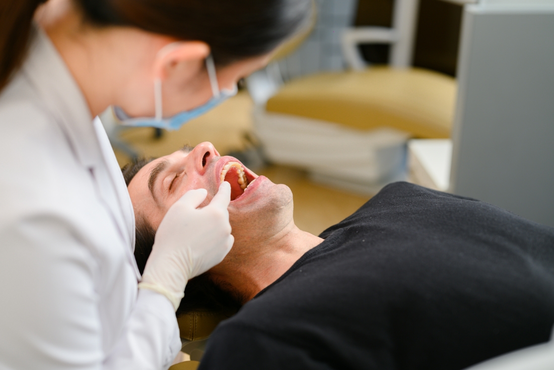 歯科矯正用アンカースクリューのメリット