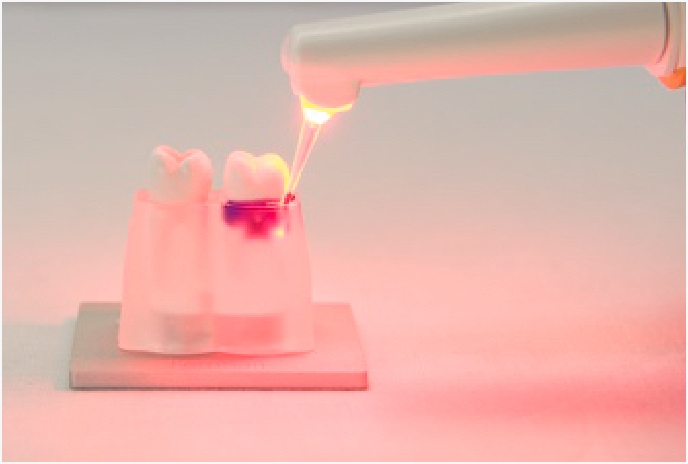 光殺菌(LAD)療法