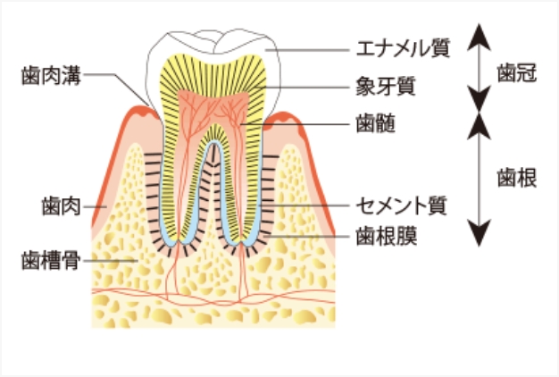 抜歯に至る原因「虫歯」と「歯周病」