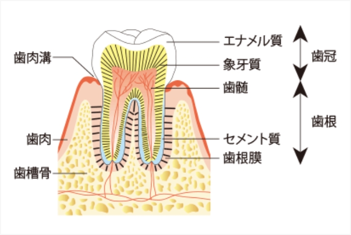 抜歯に至る原因「虫歯」と「歯周病」